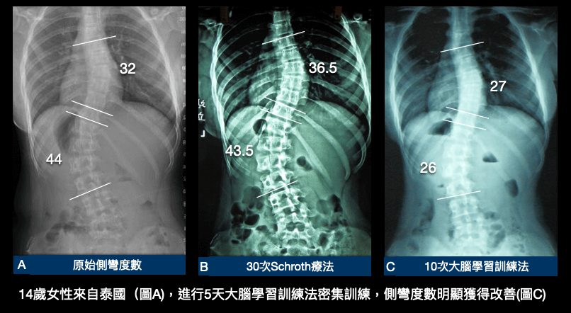 大腦學習訓練法密集訓練5天