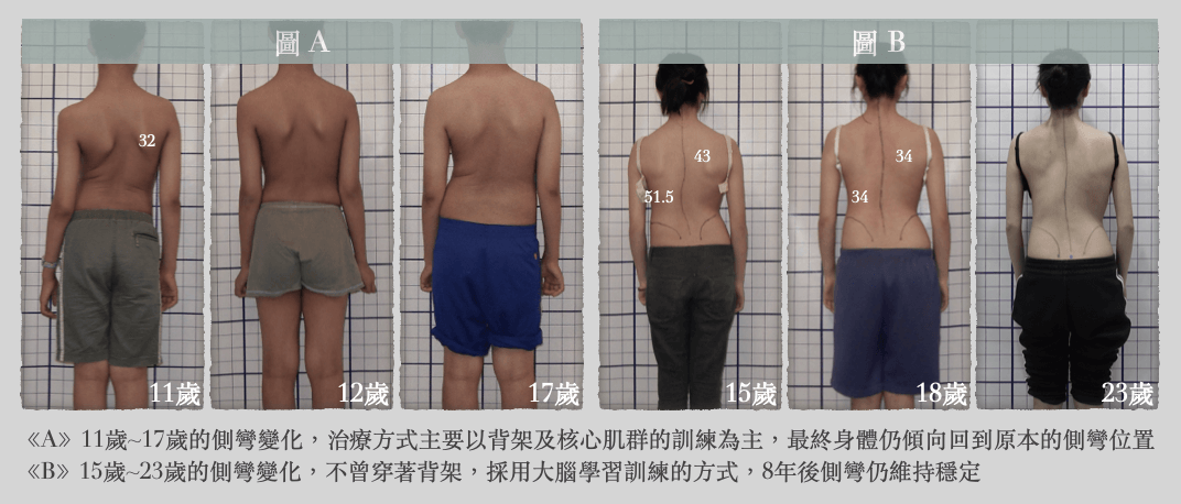 大腦學習訓練法矯正成效至少維持8年(圖B)