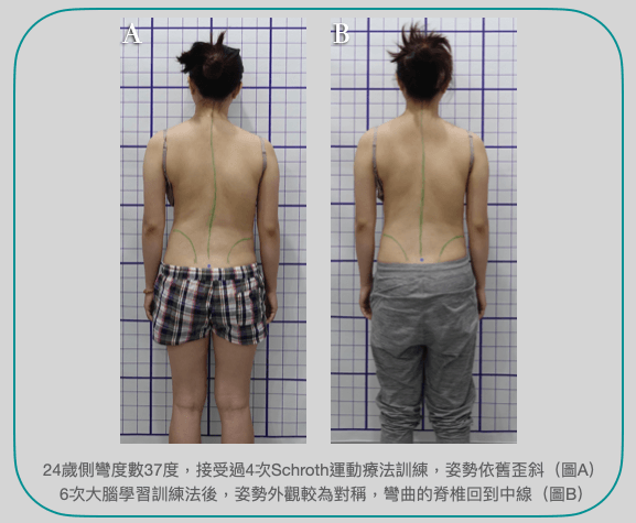 6次大腦學習訓練法明顯改善姿勢外觀