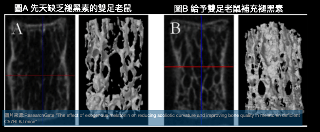 脊椎側彎原因之一：褪黑素動物實驗-補充褪黑素增加骨質密度