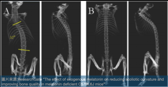 脊椎側彎原因之一：褪黑素動物實驗-先天缺乏褪黑素