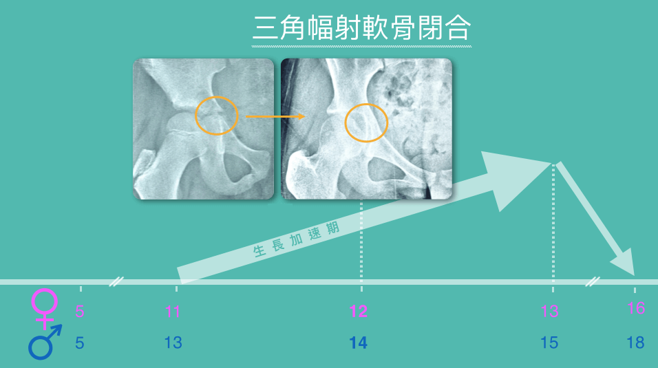 骨齡判斷-三角幅射軟骨閉合