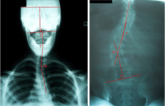 CLEAR Institute method-x ray analysis