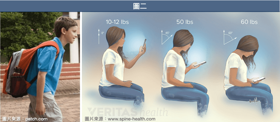 背重物、看書或使用3C產品時間過長，肩頸所承受的重量，會隨著頭部前傾的幅度增加，也很容易出現姿勢型駝背