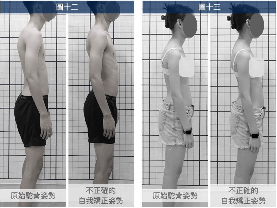 原始駝背姿勢與不正確的自我矯正姿勢