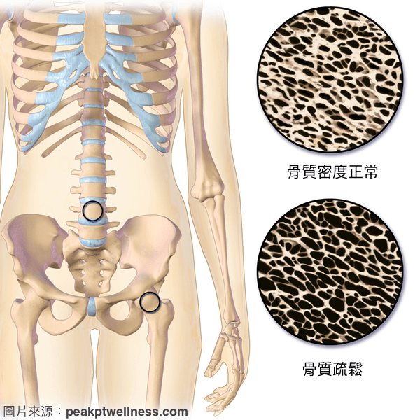 骨質密度