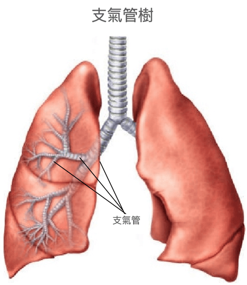 嚴重脊椎側彎會扭轉支氣管樹、擠壓支氣管，造成肺換氣不足