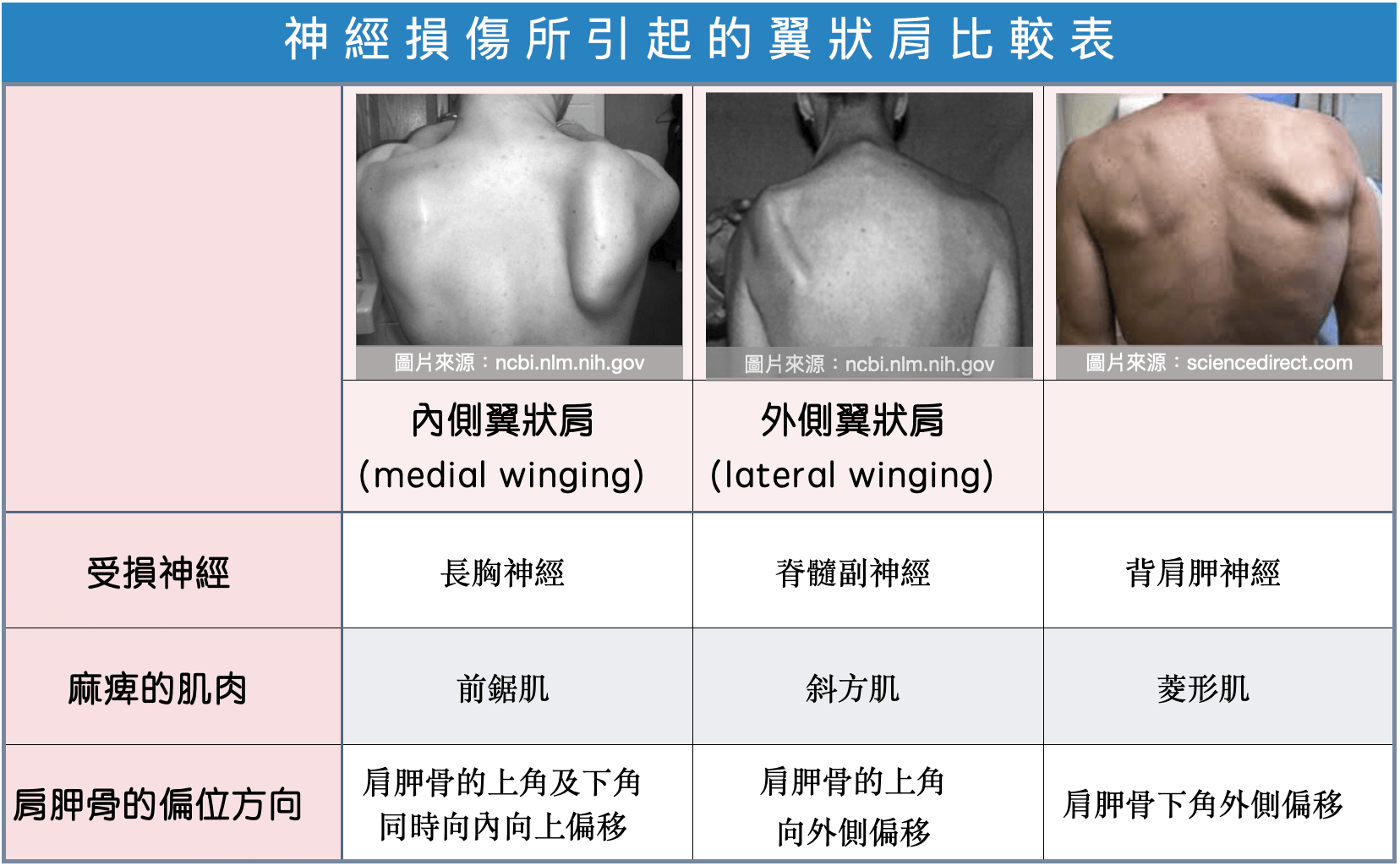 三種不同神經損傷引起的翼狀肩比較