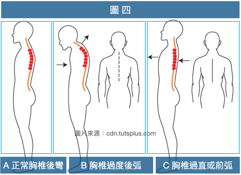 正常及異常的胸椎側面曲線