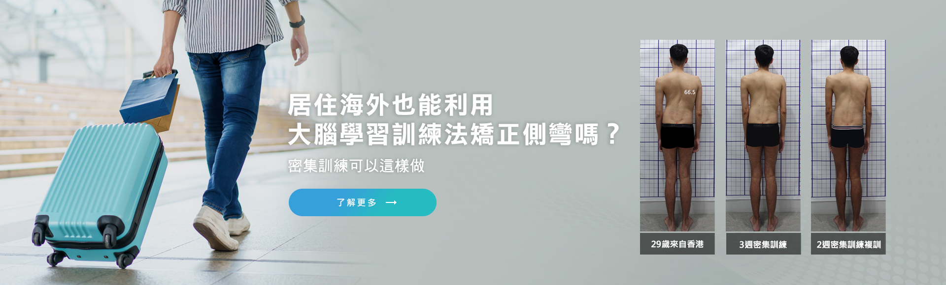 居住海外也能利用大腦學習訓練法矯正側彎嗎？