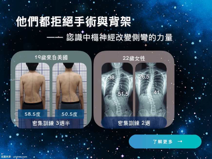 他們都拒絕脊椎側彎手術與背架-大腦學習訓練法脊椎側彎矯正體系與其他側彎矯正體系的差異