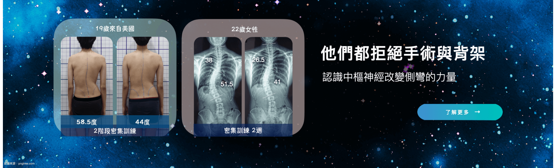 他們都拒絕脊椎側彎手術與背架-大腦學習訓練法脊椎側彎矯正體系與其他側彎矯正體系的差異