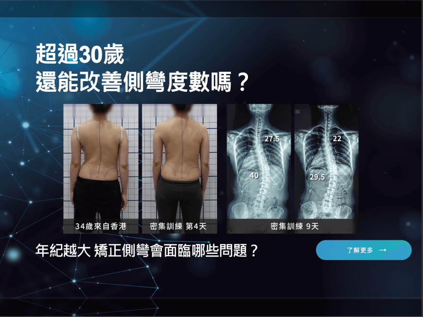 超過30歲還能改善側彎度數嗎？
