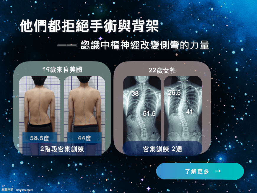 他們都拒絕脊椎側彎手術與背架-大腦學習訓練法脊椎側彎矯正體系與其他側彎矯正體系的差異