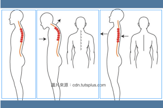 胸椎側彎怎麼辦？了解4大症狀與形成原因，正確矯正沒煩惱！